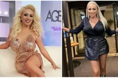 Rocsana Marcu, intervenție estetică de 8 ore la o clinică din Dubai: "Ceea ce a început ca o problemă medicală s-a încheiat cu cel mai bun rezultat posibil"