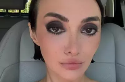 Intervențiile estetice i-au schimbat complet înfățișarea! O mai recunoști? E super celebră în România!! Foto