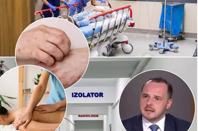 Ce simptome are lepra și cum se transmite. Două maseuze asiatice, care lucrează în Cluj, confirmate cu boala dispărută de aproape jumătate de secol