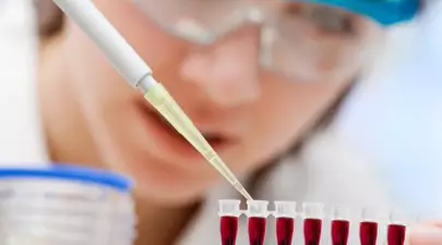 Află totul despre hepatita C – transmitere, simptome, tratament, prevenire, factori de risc