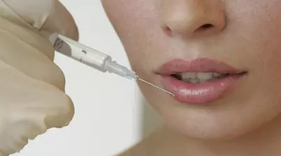 Află totul despre mărirea de buze cu acid hialuronic