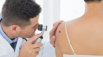 Ce tip de piele prezintă cel mai mare risc de cancer