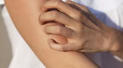 Mâncărime pe piele