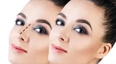 Dispozitivul care îți face nasul perfect fără bisturiu