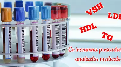 Zodiacul Chinezesc. Ce zodie chinezească ești în funcție de anul nașterii