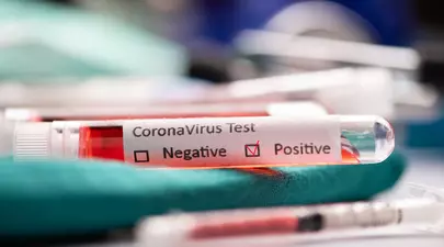 Luni, 30 martie 2020, începe testarea pentru coronavirus a bucureștenilor. Cum se va desfășura operațiunea