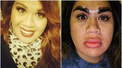 Experiență de coșmar după o vizită la cosmetică. „Când m-am privit în oglindă nu mi-a venit să cred”