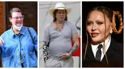 Top 6 vedete desfigurate de intervențiile estetice