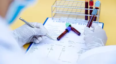 Ce teste medicale sunt necesare, în funcție de vârstă, pentru depistarea bolilor. Kate Middelton și-a descoperit cancerul în fază incipientă