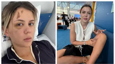 Emily Burghelea, supusă unei intervenții chirurgicale după accident. Ce diagnostic a primit: „Nu mă recunosc”