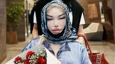 Jessica Alves, desfigurată după ce și-a făcut o nouă intervenție estetică la față. „Doctorul a putut să-mi îndepărteze cinci centimetri din piele”