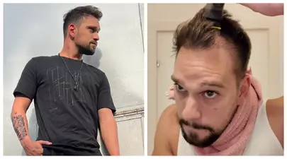 Vlad Gherman se pregătește pentru o intervenție estetică. „Urmează săptămâna viitoare. Cred că o să mă duc să plâng!”