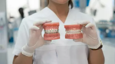 Etapele tratamentului cu aparat dentar