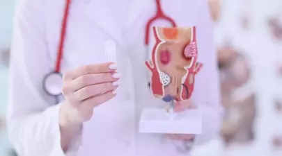 Cum se tratează hemoroizii cu unguente și medicamente recomandate de specialiști