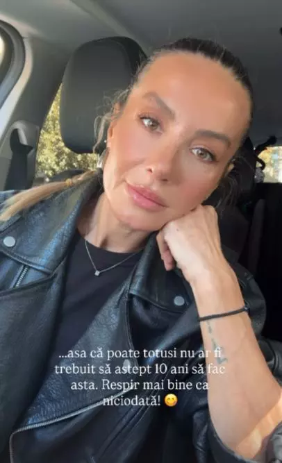 Flavia Mihășan după ce s-a operat la nas
