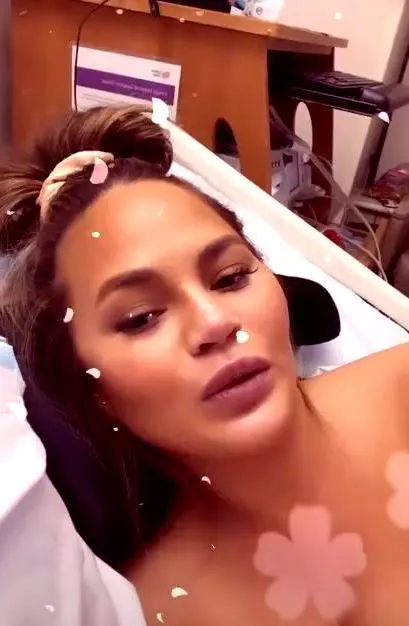 Chrissy-teigen-10-1