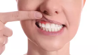 Află totul despre afecțiunile gingivale