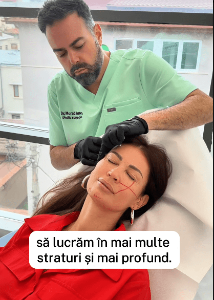 nicoleta luciu operatie