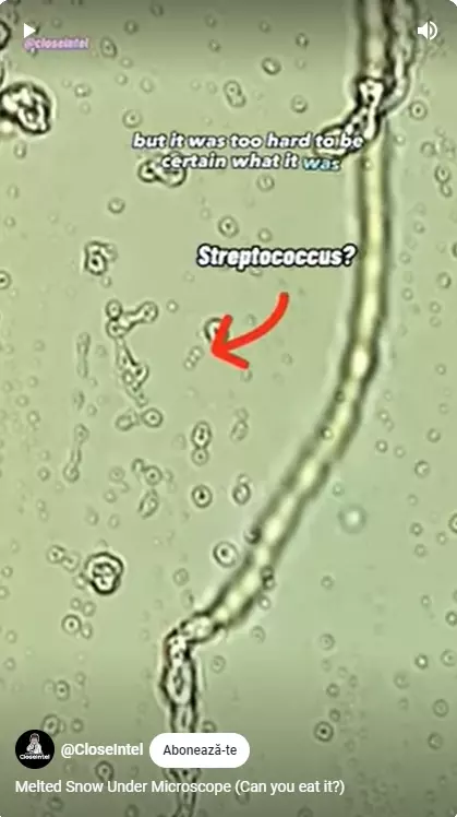 Zăpadă topită la microscop (4)