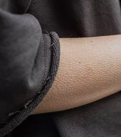 De ce se face pielea de găină şi cum apare această reacţie