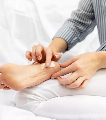 Cum să îngrijești călcâiele crăpate