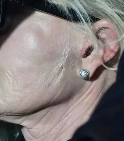 Da, e chiar ea, ne-a lăsat fără cuvinte! Are fața cusută cu fire, iar mâinile sunt pline de vânătăi! A fost de o frumusețe angelică însă azi actrița noastră e complet transformată