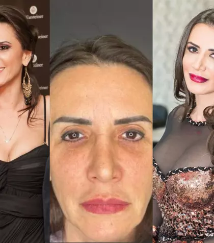 Mara Bănică, răspuns tranșant după operația la față. Imagini incredibile înainte și după: „Cred că sunt un exemplu de lifting facial reușit”