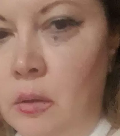 Oana Lis, în lacrimi după ce a ajuns pe patul de spital. Ce a pățit soția lui Viorel Lis