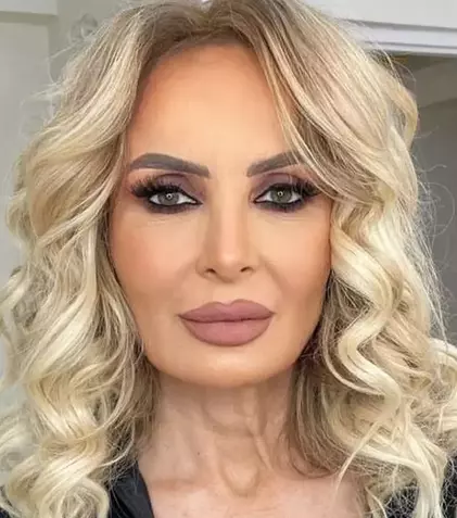 Cum arată acum Daniela Gyorfi după noile intervenții estetice. A plătit 5.000 de euro