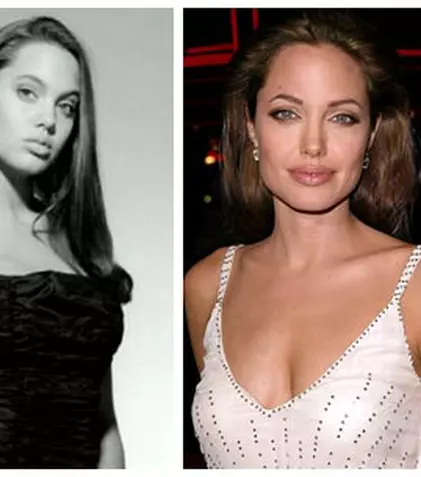 Cum arată vedetele înainte și după operațiile estetice