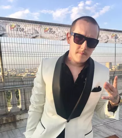 What’s Up s-a operat de urgență. Artistul risca să-și piardă vederea