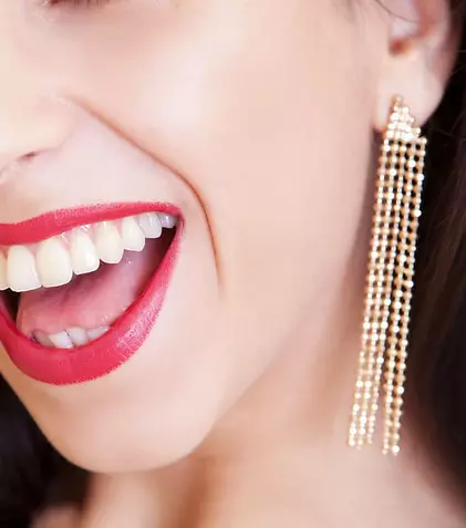 Cum îngrijești fațetele dentare? Precauția, cuvântul de ordine pentru zâmbetul perfect!