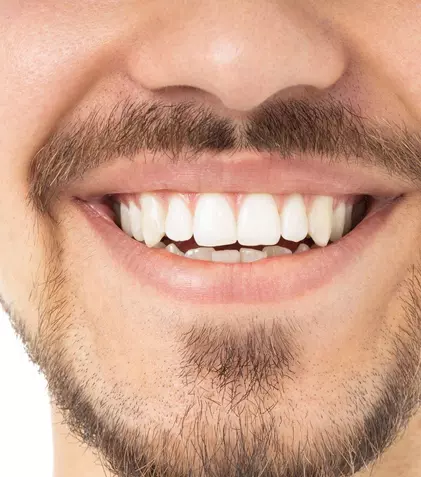 Arhitectura zâmbetului perfect: cum zirconiul redefinește rezistența în estetica dentară