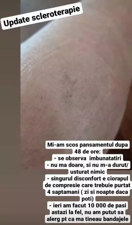 carmen-bruma-interventie-1