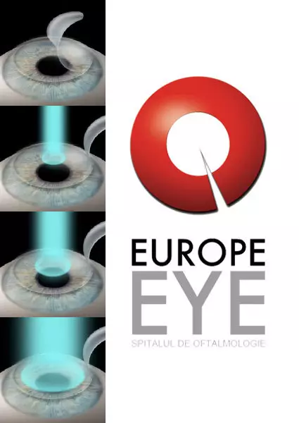 (P) Spune NU ochelarilor!