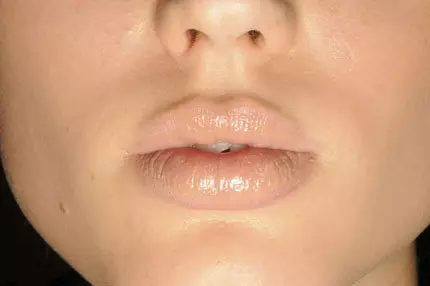 Francesco Scognamiglio