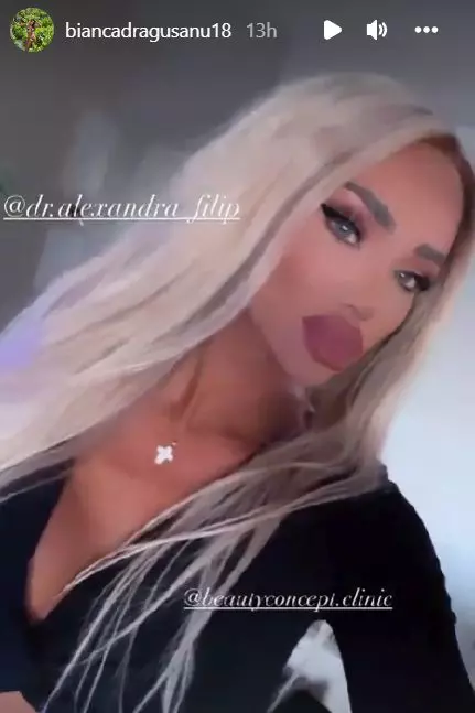 Bianca-Dragusanu-a-apelat-la-o-noua-interventie-estetica-1