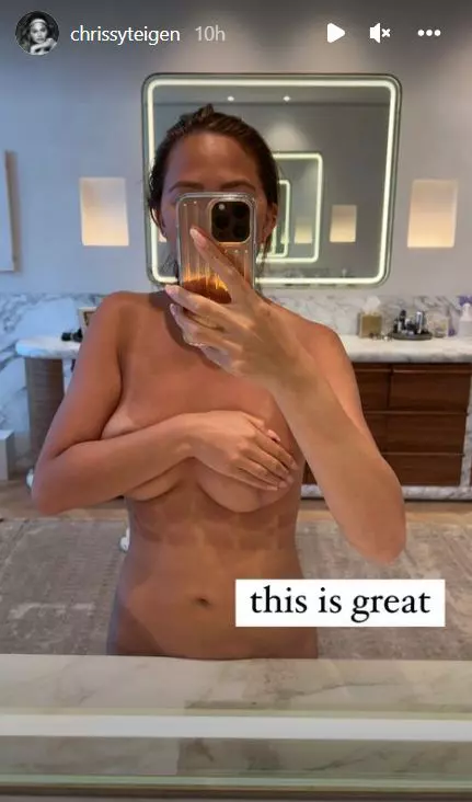 Chrissy-Teigen