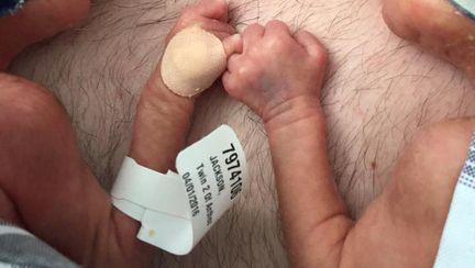 Imagini incredibile cu gemeni prematuri. Cum se protejează unul pe celălalt | FOTO & VIDEO