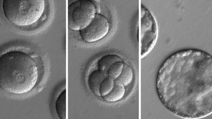 Premiera in lumea medicala A fost editat ADN-ul unui embrion uman
