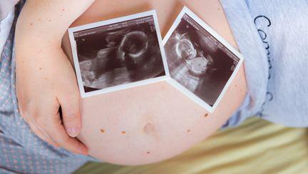 Este posibil să curățați buricul în timpul sarcinii? - Probleme
