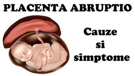 Placenta abruptio - Cauze si simptome