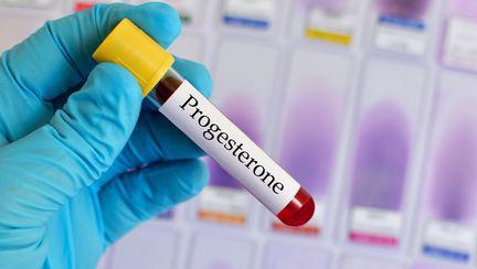 Suplimentul de progesteron in sarcina - Cand este necesar