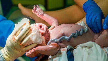 Amanarea primei baite a nou-nascutului ar avea beneficii pentru alaptare