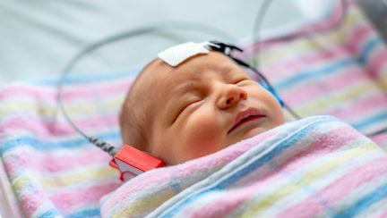 Semnele unei deficiente de auz la bebelus - Cand sa te ingrijorezi