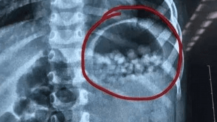 A crezut ca ii da copilului bomboane colorate. Cand a realizat greseala, a ajuns la Urgente