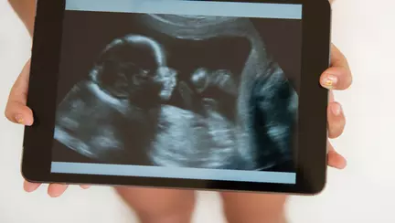 Pozitionarea copilului inainte de nastere