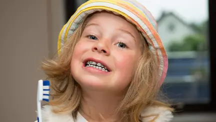 Dintisori strambi? Sa-i indreptam!