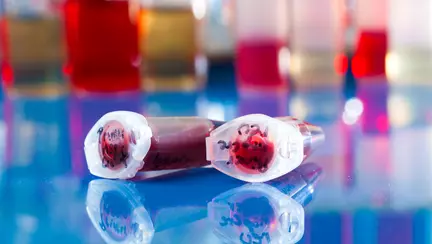 Celulele stem, dincolo de poveste