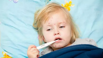 Bebeluşul meu a făcut vărsat de vânt – povestea Cristinei